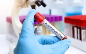 B2-GPI Antibodies IgM