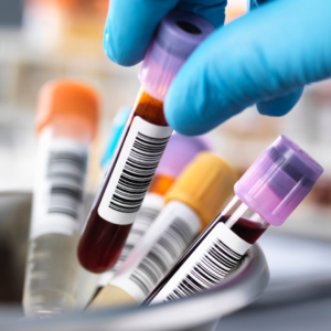 Chronic Infection Serology Panel