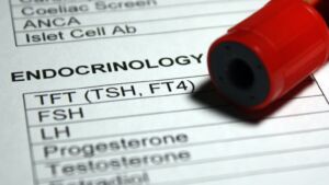 Triiodothyronine (T3)